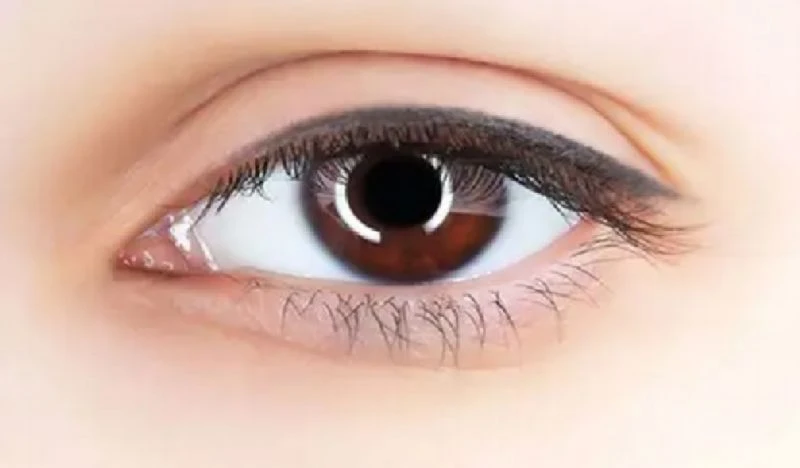 Eye Health Eye Health